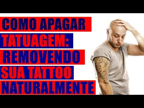 Como Apagar Tatuagem – Removendo Sua Tattoo Naturalmente