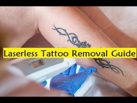 Guia de remoção de tatuagem sem laser – Método para remover tatuagens naturalmente de casa sem laser