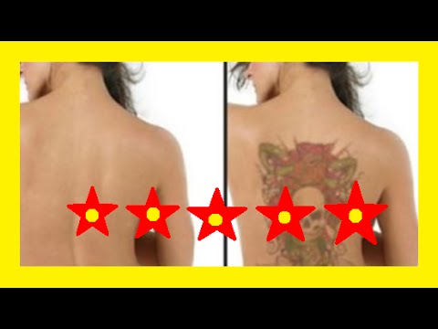 Como remover tatuagem de maneira Natural